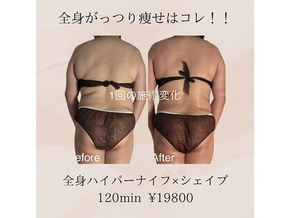 サンナナヨンプラス(374+)の写真