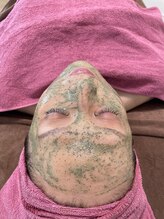 デュクレ(Beauty Clinic Ducle)/大人気のREVI陶肌トリートメント