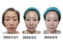 そら/小顔/ヘッドマッサージ