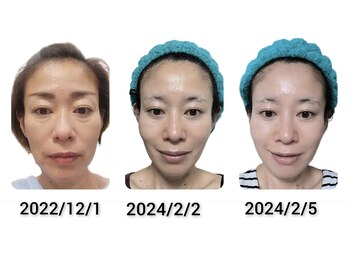 そら/小顔/ヘッドマッサージ/神経整体