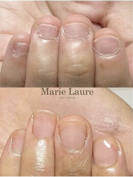 マリーロール 天王寺店(Marie Laure)/自爪育成/深爪矯正/ネイルケア