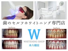 ホワイトニングショップ 本八幡店