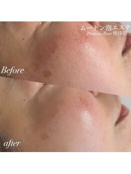 プリンセスローズ 焼津店(Princess Rose)/ムートン泡エステ