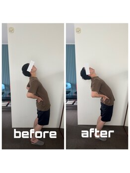 イトウ カイロプラクティックパートナー(ITOU)/Before &After