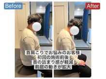 アンティオール 桜木町店/Before→After