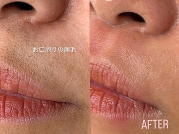 アイロンボーイ(IRONBOY)/艶肌お顔全体WAX