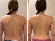 エステサロン オージャス(Ojas)の雰囲気（最速で結果の出ると口コミ大好評のブライダルエステ♪）