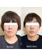 グレイス(Grace)の写真/ほうれい線・たるみをケア!ふっくらハリ肌で明るい印象に☆肌悩みに徹底アプローチ◎是非お試しください◇