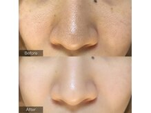 ルアナ(Luana)の雰囲気(毛穴悩みに特化したメニュー多数取り扱い◆憧れの毛穴レス肌に)