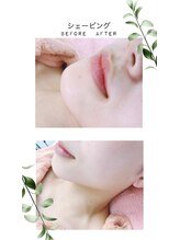 ソルシエール キレイ(ソルシエールkirei)/レディースシェービング