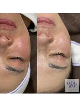 プアメリア(Pua Melia)/マリムーブフェイシャルワックス