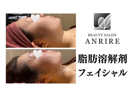 アンリール 美幌町店(Anrire)の写真