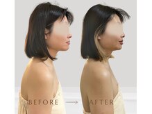 姿勢改善すると小顔に変わる