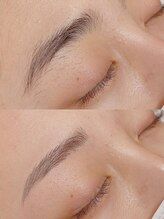 ビィラボネクスト(BELAB NEXT)