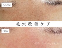 ウェヌ(VENE)