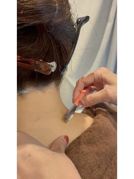 リノン(Rinon)/