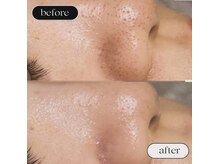 アウラ(AURA)/近くで見られても平気！