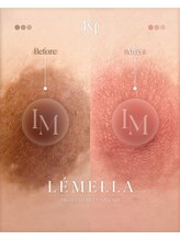 ハニー 横浜店(HONEY)/バストアップサロンHONEY横浜