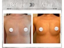 フェリス(Feliz)/【バストアップ/育乳/安城】