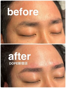 【DOPE:ドープ】新宿駅前（メンズ眉毛サロン/眉毛専門/アイブロウ/眉毛パーマ/まゆげ)/[メンズ/眉毛/アイブロウ/新宿]
