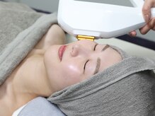 チャッピー(CHAPPY)