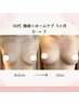 【写真モニター限定】バストアップ×姿勢改善×全身施術120分×3回で集中ケア