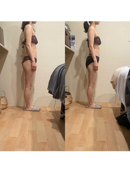 トトノエル(TOTONOEL)/姿勢矯正筋膜リリース