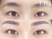 レピア 仙台店/韓国式LEPIA Before&Aｆter