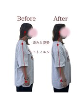 整体院トトノエル 西川原院/Before→After 