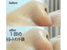 【毛穴洗浄・毛穴の黒ずみ対策】徹底ケア！毛穴エステコース　1回　￥3980