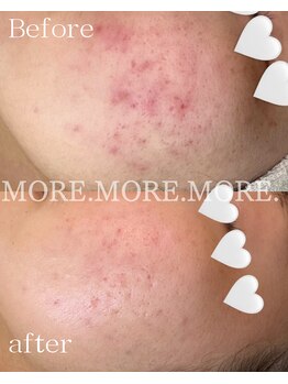 モア 吉祥寺(MORE.)/BeforeAfter