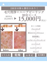 脱毛マックス 南越谷店(MAX)/エステ人気Ｎｏ．1 毛穴×ハーブ