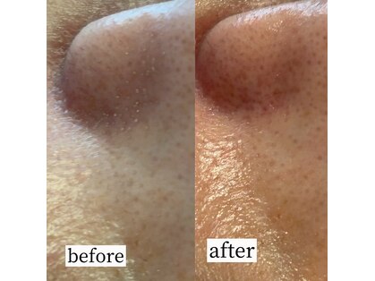 チアリー(Chiary)の写真