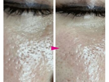 プリオール 高崎花水木店(Prior)/ヒト幹細胞×エステダーマ