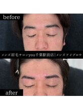 ユー 千葉駅前店(you)/ビフォ－アフター写真