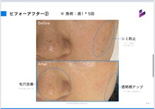 サロン チコルル(salon chikolulu)