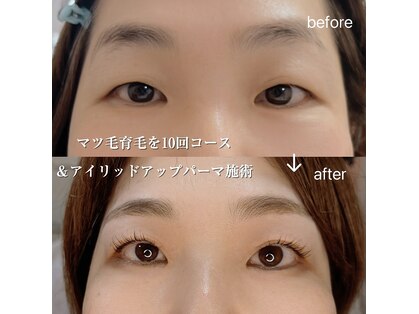 プリティアイ(pretty eye)の写真