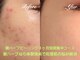 ティンクル(TWINKLE)の写真