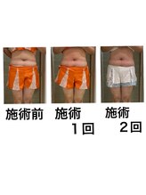 鍼灸サロンオランジュ 高槻富田院/