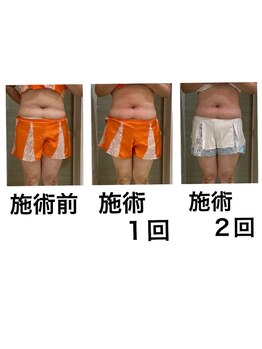 鍼灸サロンオランジュ 高槻富田院/