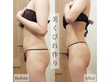 レイプラス イオン卸町店(RAY PLUS)/◆ビフォーアフター例のご紹介◆