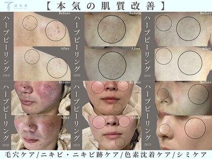 透肌美(トウキビ)の写真