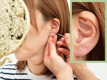 ポ/耳つぼジュエリーセット