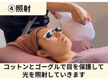 ビエスト(美est)/光を照射