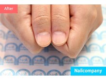ネイルカンパニー/