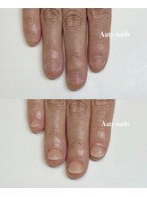 アーティネイルズ(Aaty Nails)/爪がなくても大丈夫
