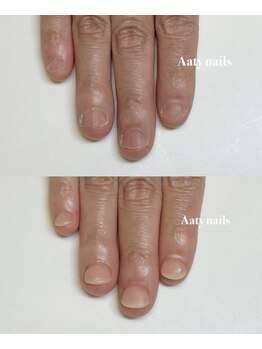 アーティネイルズ(Aaty Nails)/爪がなくても大丈夫