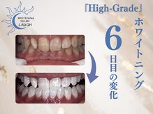 ラフ(LAUGH)/【審・美・白】 ホワイトニング