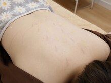 はり灸マッサージえみ