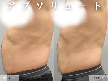 レヴェリー 心斎橋店(REVERIE)/‐ ぽっこりお腹にアプローチ ‐